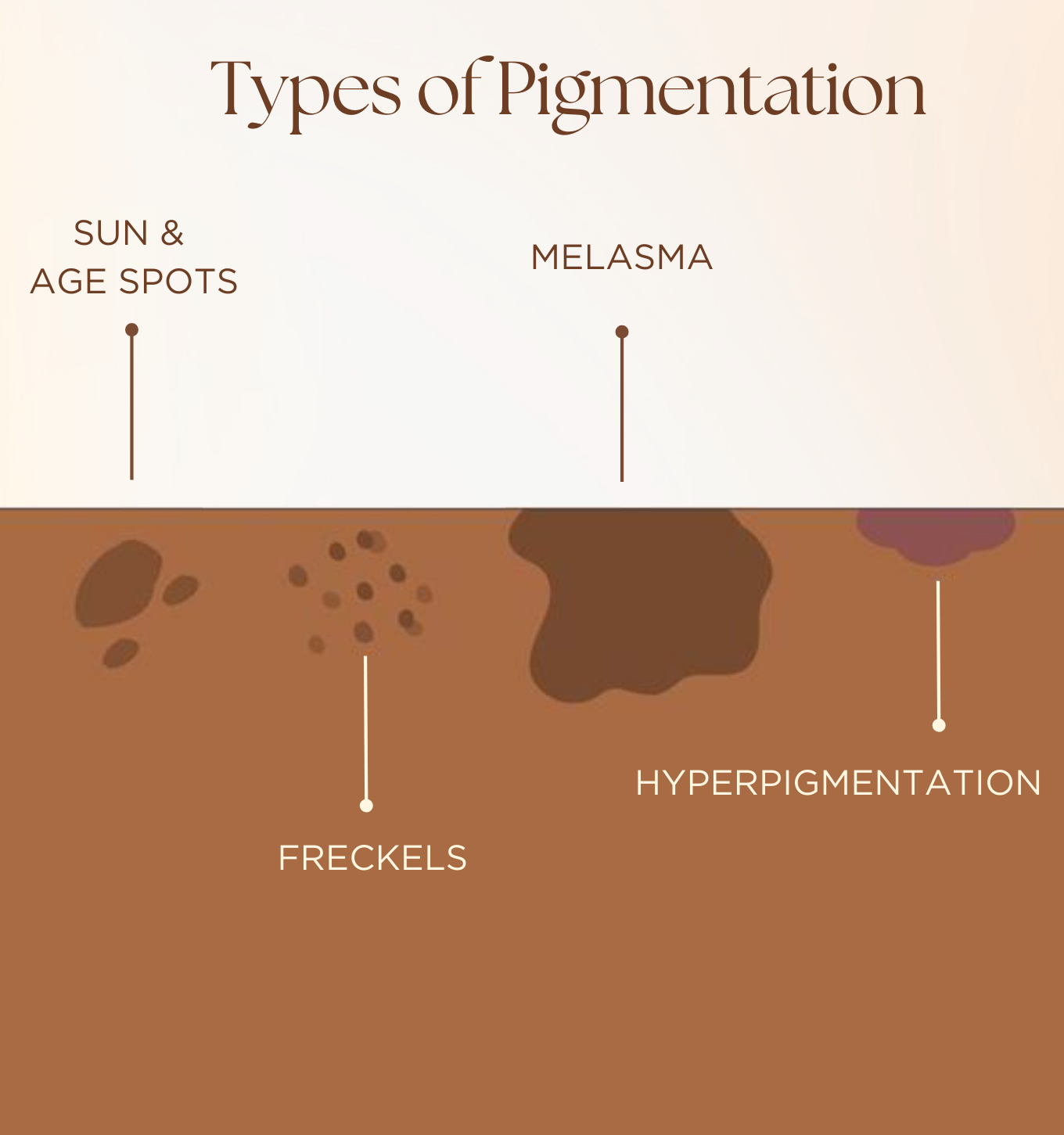 types of pigmentation on face, anti pigmentation facial, best product for pigmentation on face, skin products for even skin tone, reduce hyperpigmentation