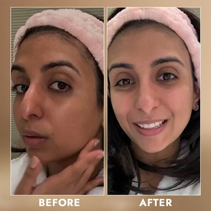 face mask for dry skin