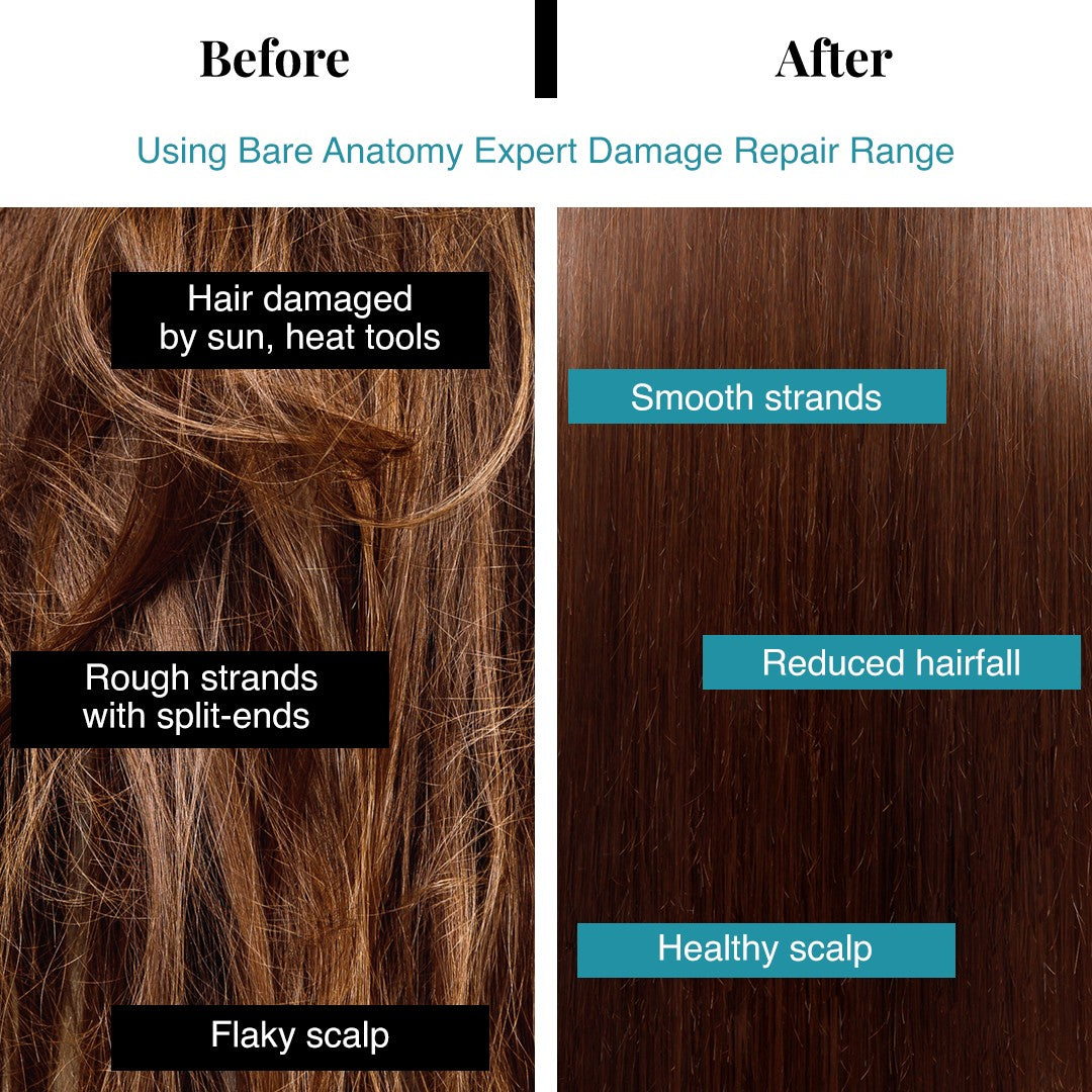 Damage Repair Shampoo for Dry & Brittle Hair | 10X Hair Strengthening- 250 ml | Pack of 3