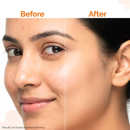 Pore Minimizing Sunscreen Gel with SPF 50 & PA+++ For Open Pores & UVA/UVB Protection - 50 g