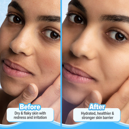 Barrier+ Repair Moisturizer | Aqualogica at Broadway