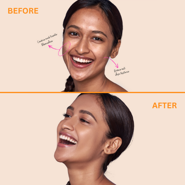 Zit Quit Liquid Concealer | Type Beauty Inc. at Broadway
