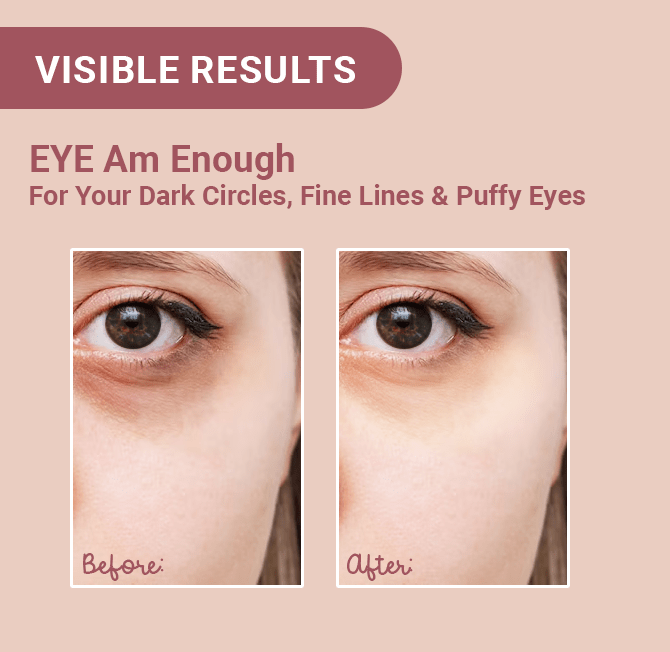 EYE Am Enough Under Eye Cream for Dark Circle Reduction | Complete Under Eye Care with Milk Actives + Micro Encapsulated Caffeine + Multi Peptides - Neude Skin