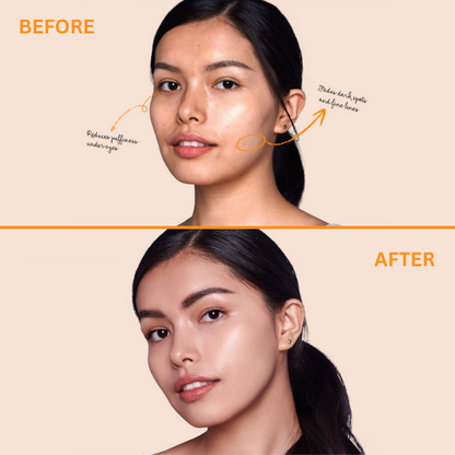 Eye Light Liquid Concealer | Type Beauty Inc. at Broadway