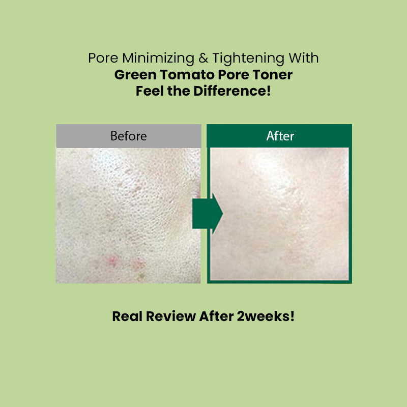 Sungboon Editor Green Tomato Pore Lifting Toner (350ml) | Sungboon Editor at Broadway
