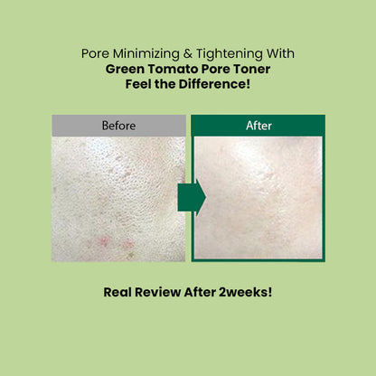 Sungboon Editor Green Tomato Pore Lifting Toner (350ml) | Sungboon Editor at Broadway