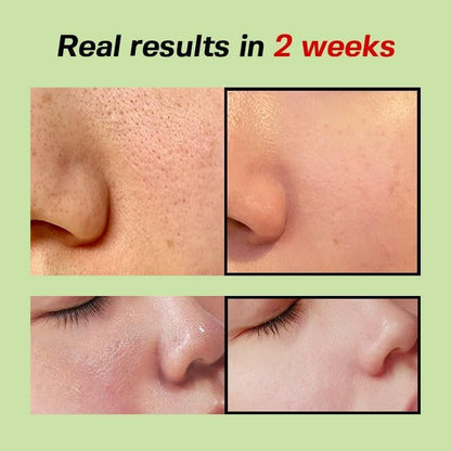 Sungboon Editor Green Tomato Pore Lifting Ampoule+ | Sungboon Editor at Broadway
