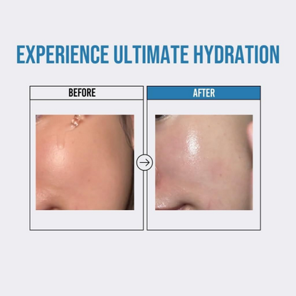 Jumiso Waterfull Hyaluronic Acid Serum 20 ml