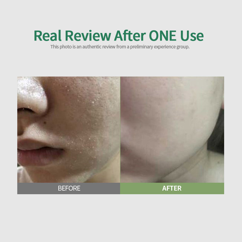 Sungboon Editor Green Tomato Deep Pore Clean Enzyme Powder Wash - (1.5g/10ea) | Sungboon Editor at Broadway