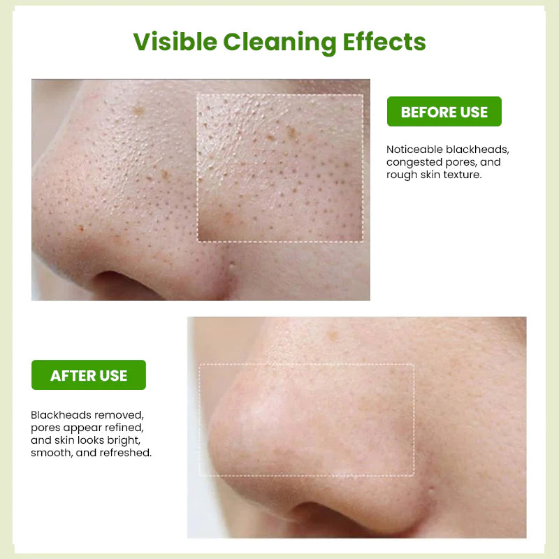 Sungboon Editor Green Tomato Deep Pore Cleansing Tissue (50g, 10pcs)