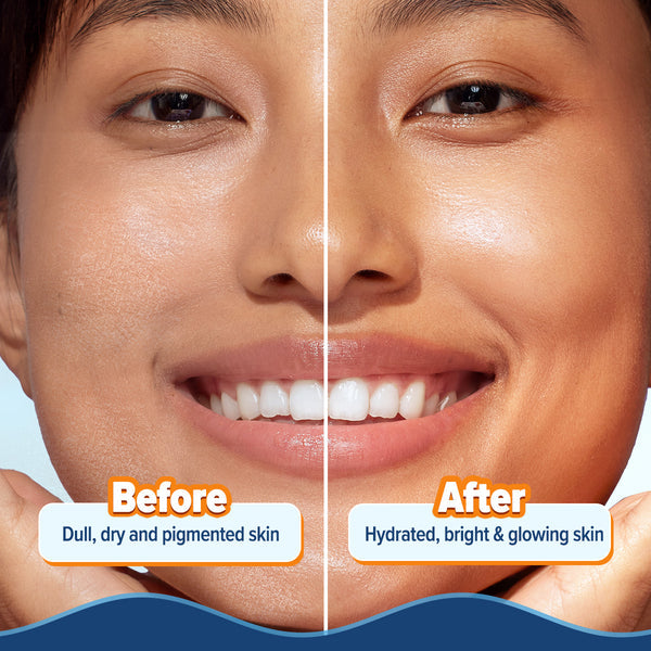 Glow+ Hydra Gel Moisturizer | Aqualogica at Broadway