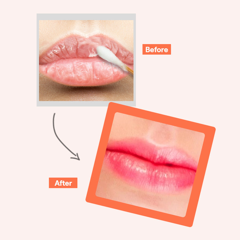 MEDIHEAL Pantenolips Healssence Coral