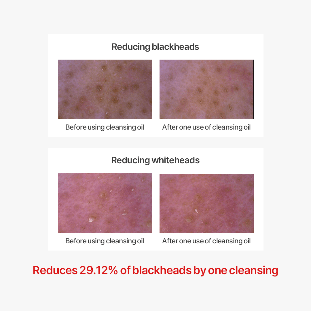 Thank You Farmer Pollufree Cleansing Oil