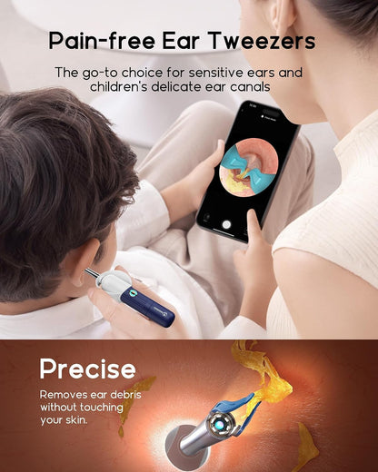 Manimo Smart Visual Ear Cleaner with ENT Kit