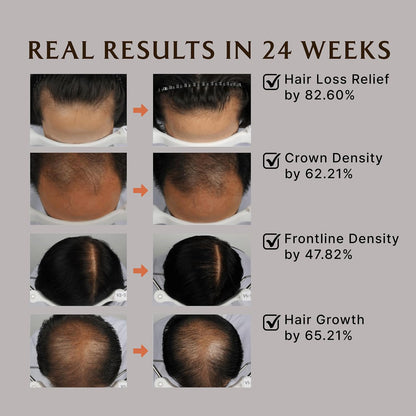 LADOR Dermatical Hair-Loss Treatment Conditioner
