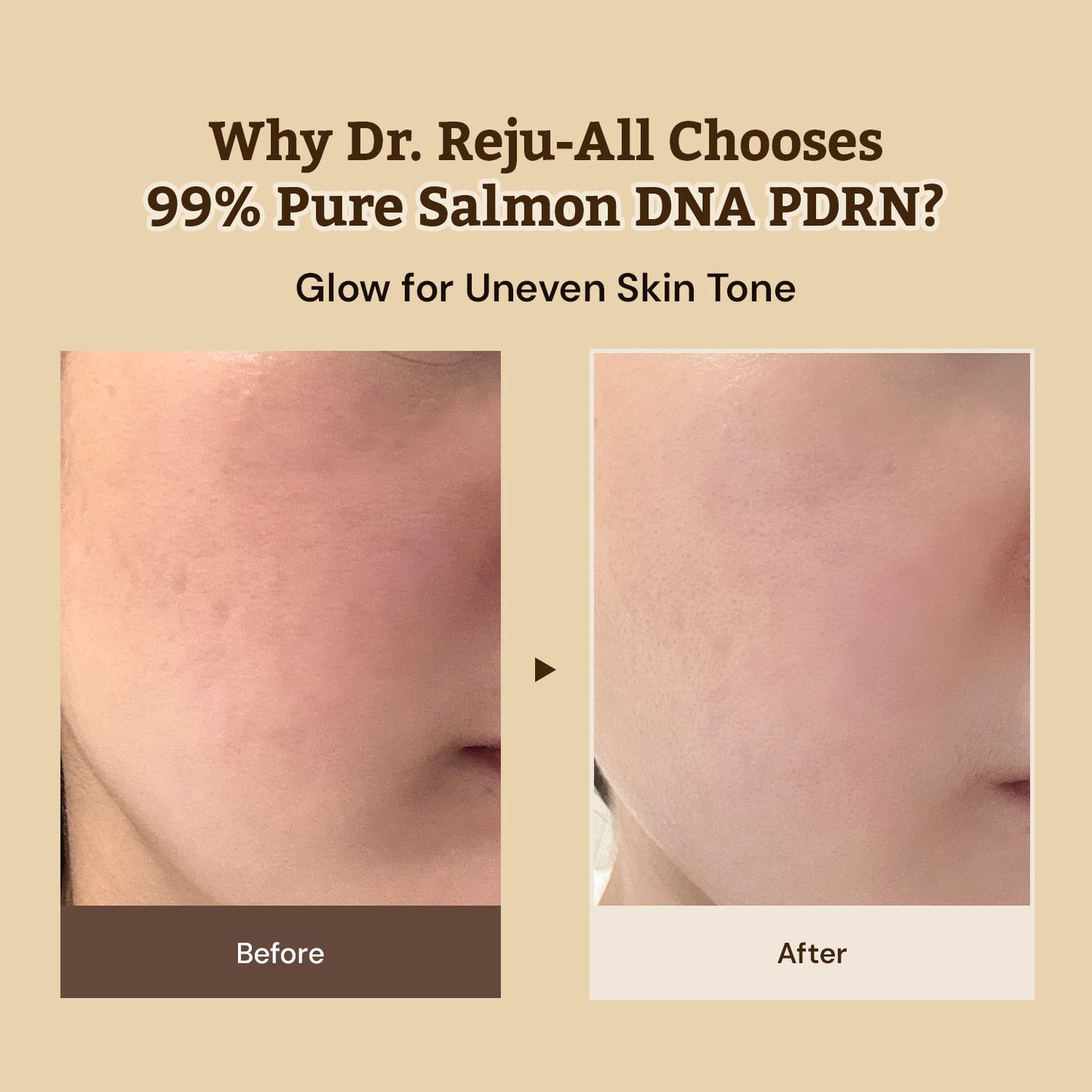 Dr.Reju-All Advanced PDRN Rejuvenating Cream