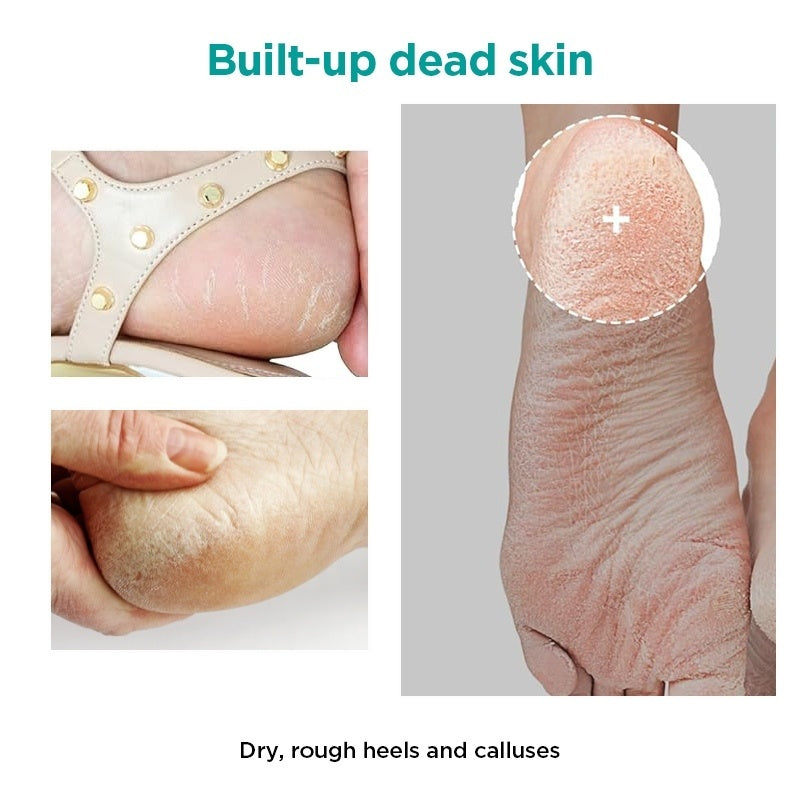 Ariul Smooth & Pure Foot Peeling Mask