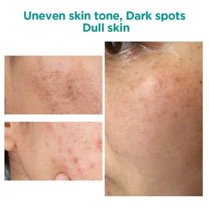 Ariul Expert Niacin Vita 5% Film Gel Mask