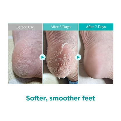 Ariul Smooth & Pure Foot Peeling Mask Exfoliating (Kiwi)