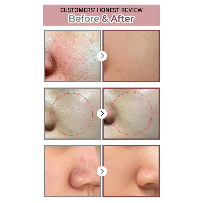 Numbuzin No.3 Tingle-Pore Softening Sheet Mask