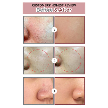 Numbuzin No.3 Tingle-Pore Softening Sheet Mask