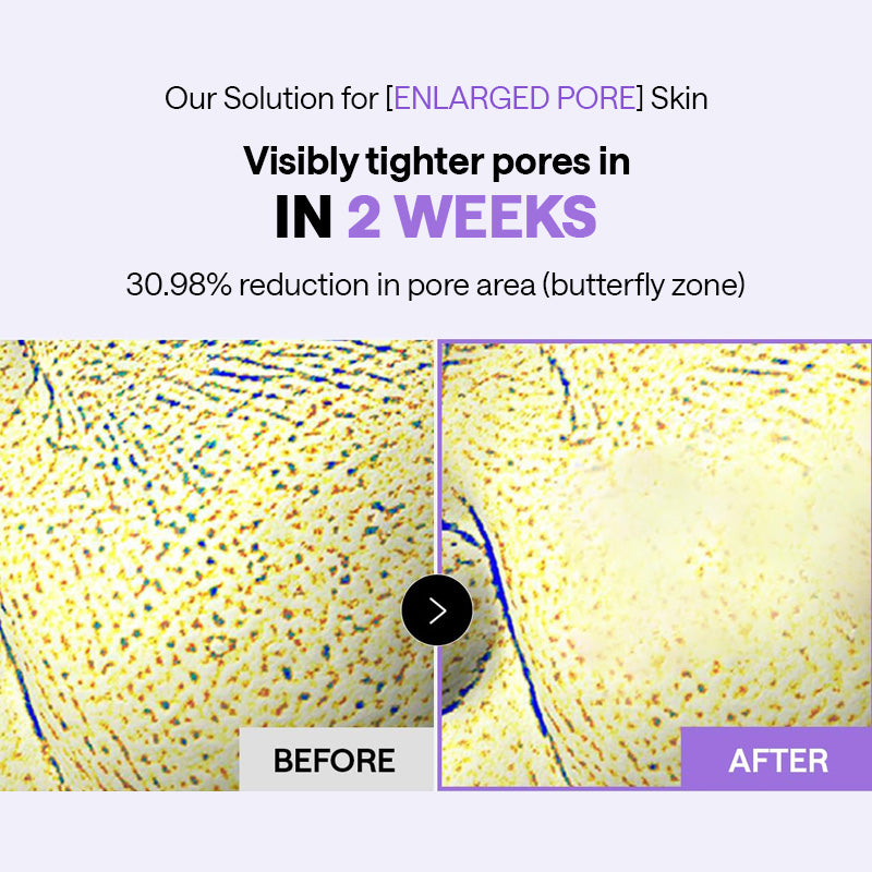 MEDIHEAL PDRN Lifting Pad