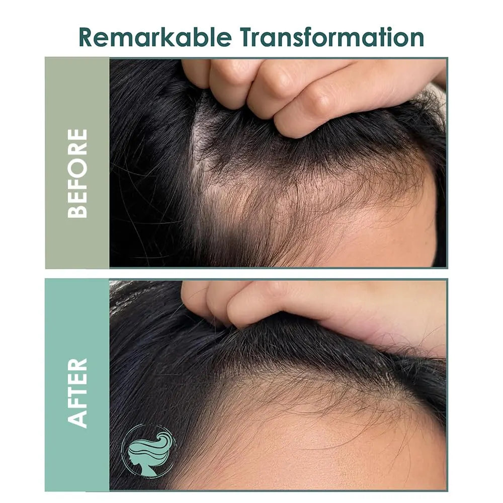 SH-RD Full Thick Hair Loss Scalp Essence | Sulfate-Free & Silicone-Free | Scalp Treatment for Thinning Hair