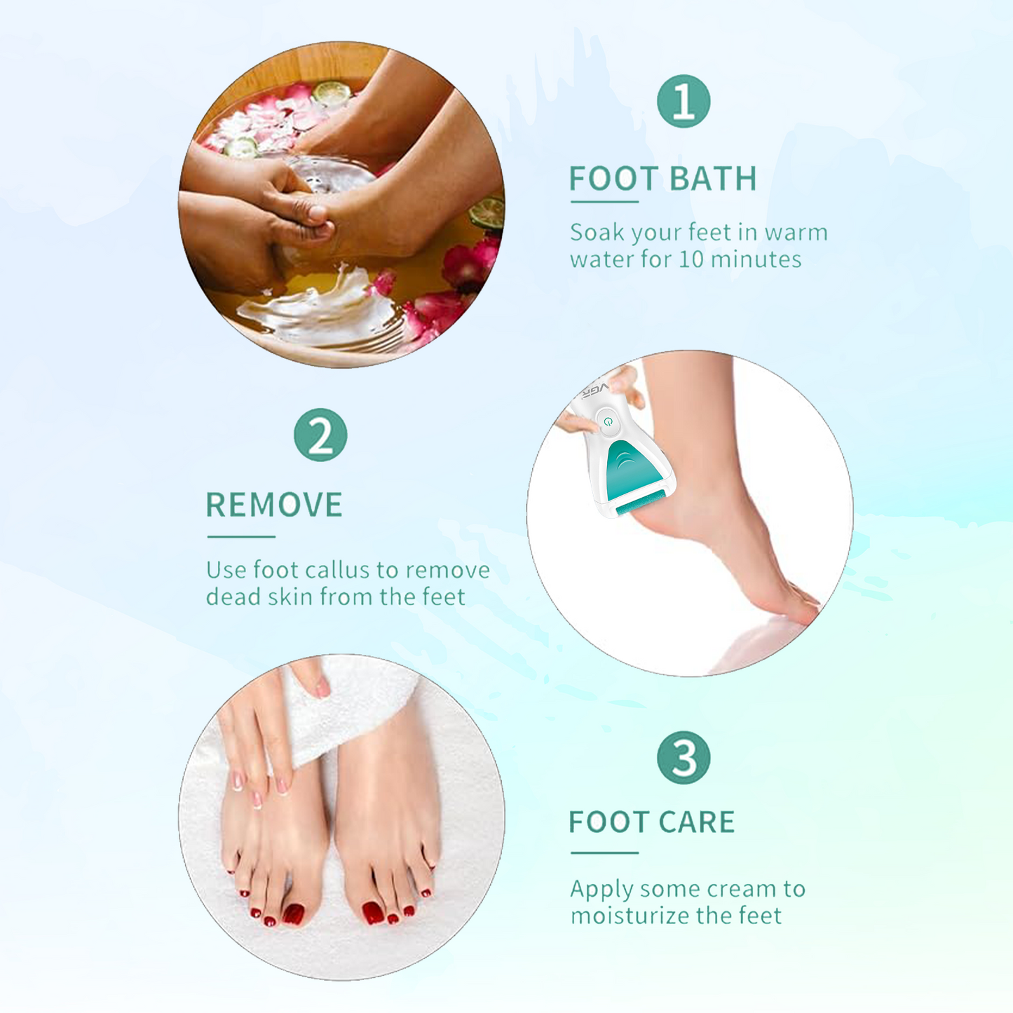 VGR V-812 Callus Remover