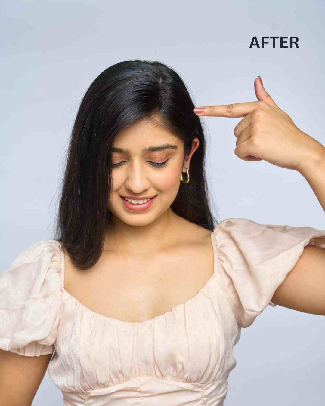 Front Hair Thinning Cover Up Patch | Nish Hair at Broadway