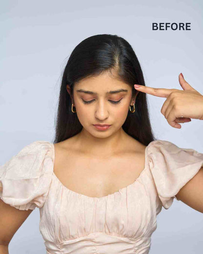 Front Hair Thinning Cover Up Patch