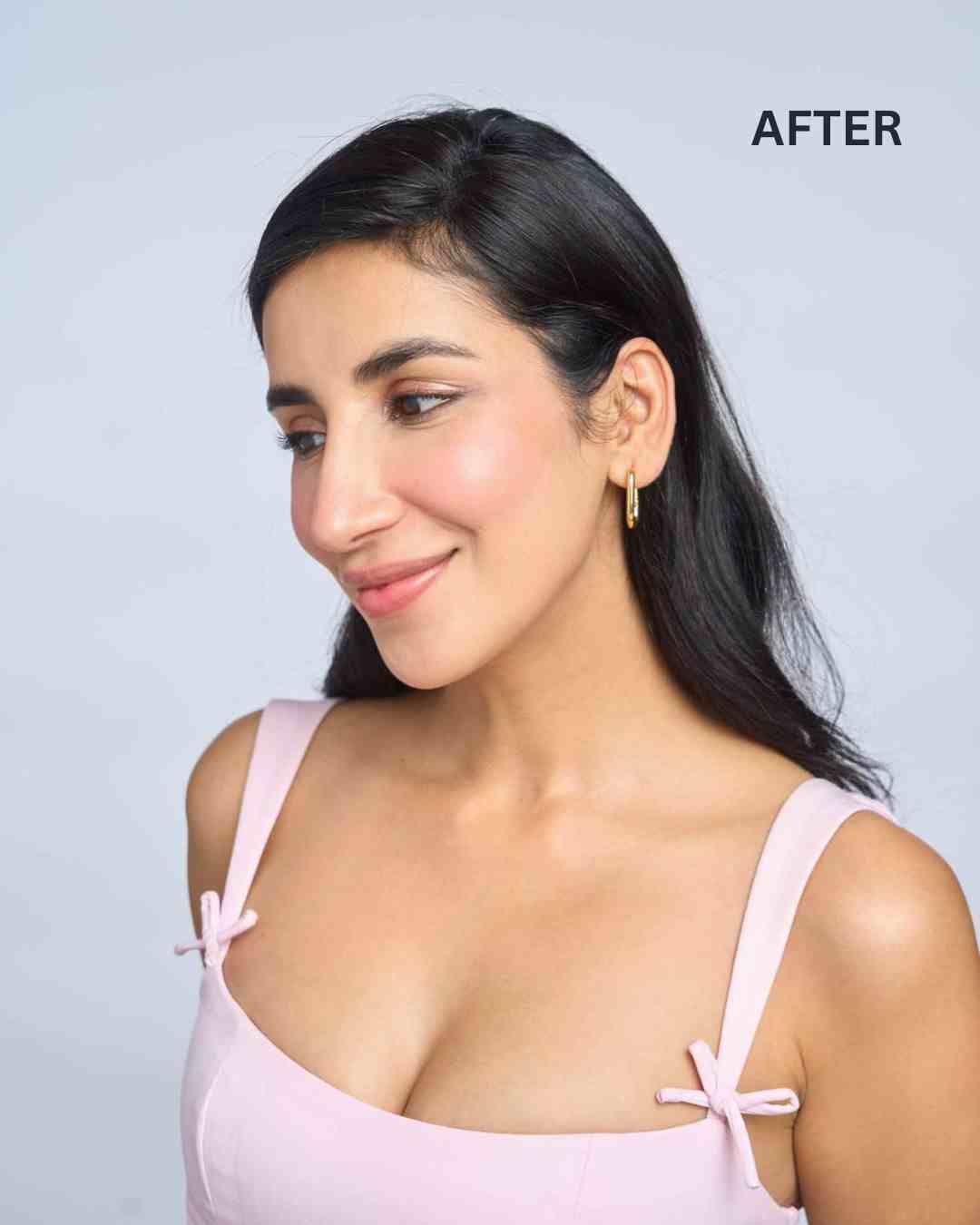 Front Hair Thinning Cover Up Patch