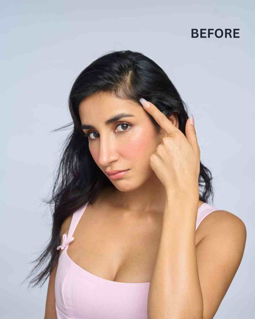 Front Hair Thinning Cover Up Patch