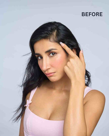 Front Hair Thinning Cover Up Patch