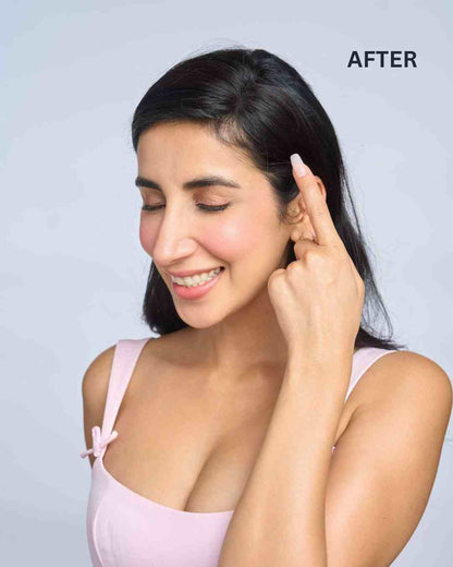 Front Hair Thinning Cover Up Patch