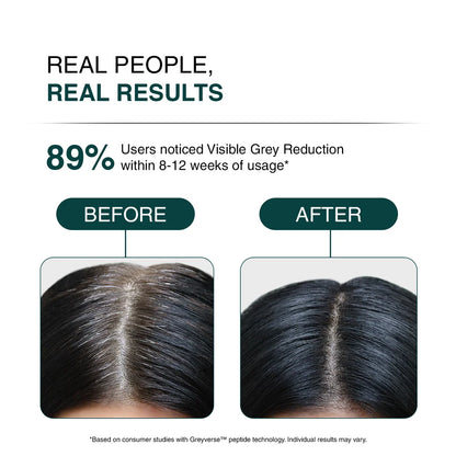 SH-RD Intensive Root Repair Essence (Anti-aging)