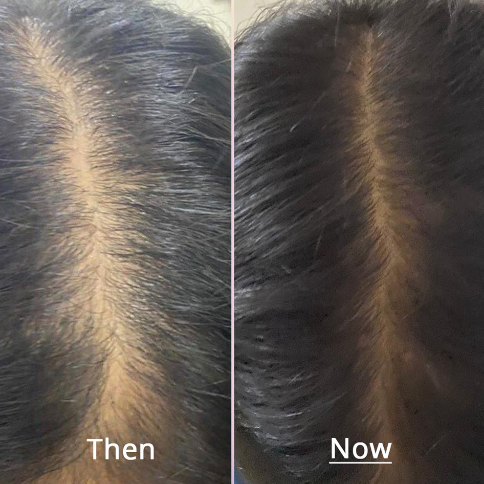 Dr.Su Rescue Hair Nourishing Oil | Dr. Su at Broadway