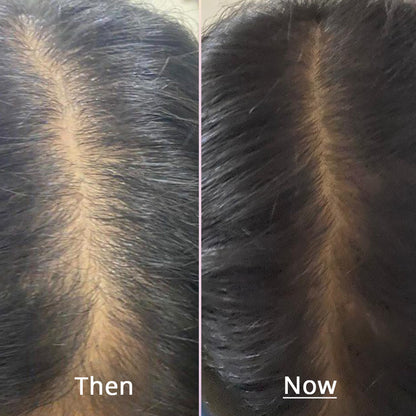 Dr.Su Rescue Hair Nourishing Oil | Dr. Su at Broadway