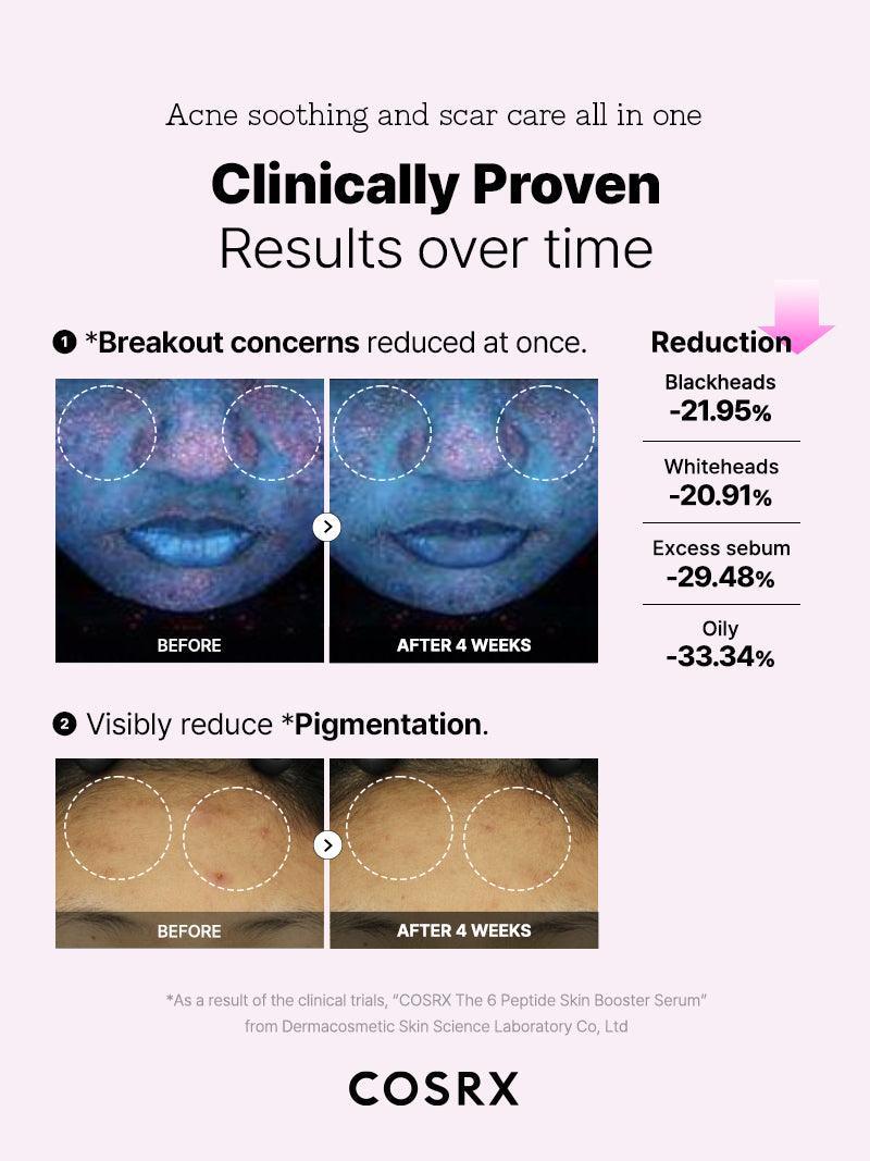 The 6 Peptide Skin Booster  - 150mL (5.07 fl.oz) | Cosrx at Broadway