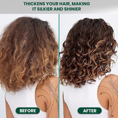 SH-RD Resolve Scalp Essence | Sulfate-Free & Silicone-Free | Balancing Scalp Treatment for All Scalp Types