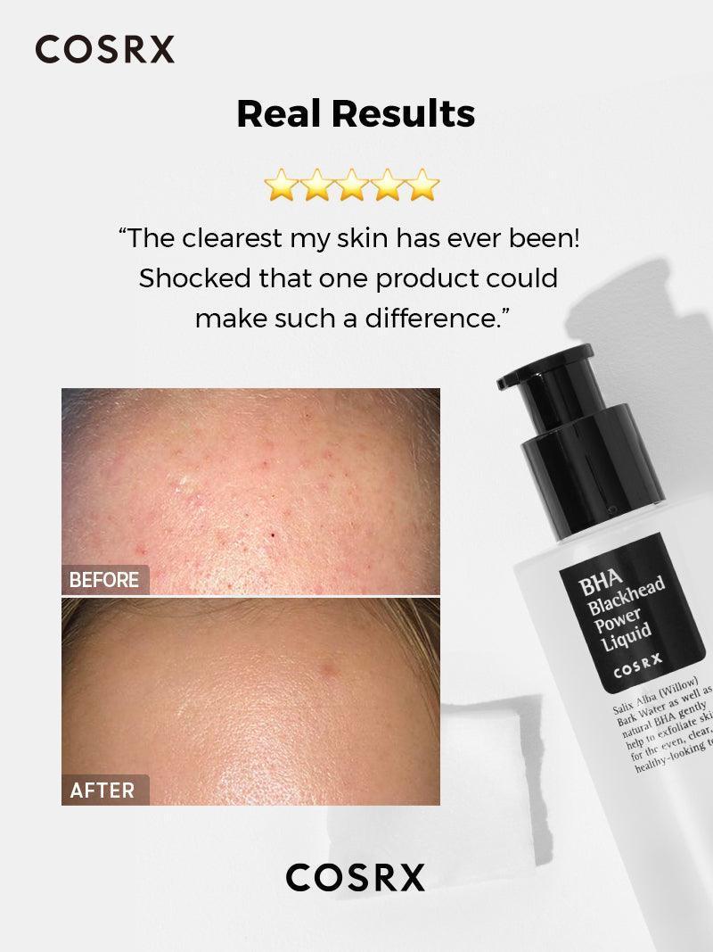 BHA Blackhead Power Liquid | Cosrx at Broadway