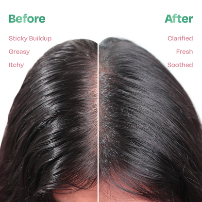 Clarifying Scalp Detox Mask for Oily & Greasy Scalp Herbal Hair Mask for Buildup & Itch (200g) | Sacred Grove at Broadway