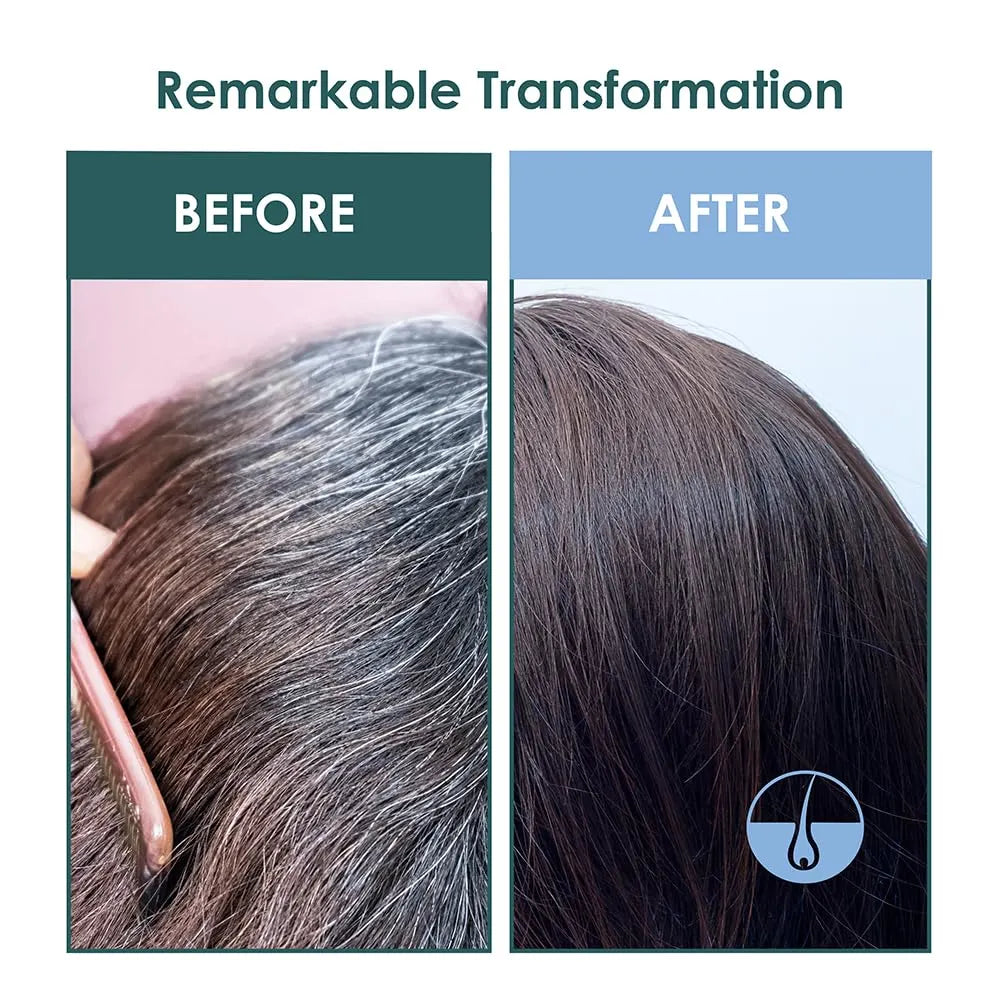 SH-RD Intensive Root Repair Scalp Essence | Sulfate-Free & Silicone-Free | Anti-Aging Scalp & Hair Treatment