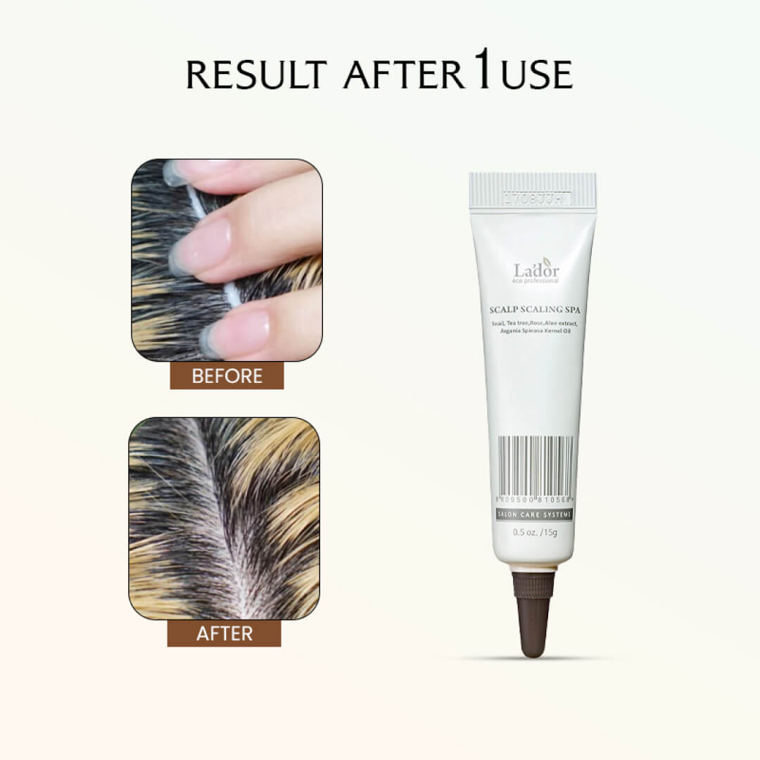 Lador Scalp Scaling Spa 15gms