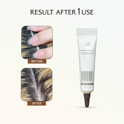 Lador Scalp Scaling Spa 15gms