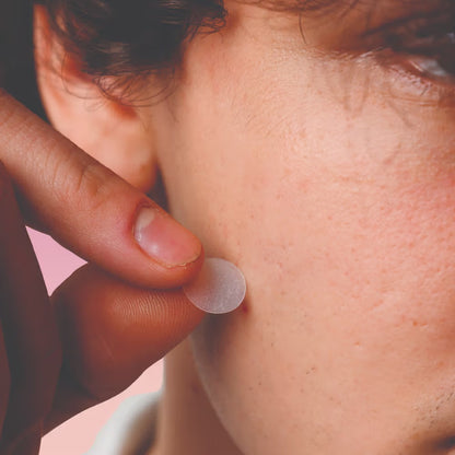 Feel Good Club Pimple Patch With Hydrocolloid & Salicylic Acid For Acne Healing & Spot Correction