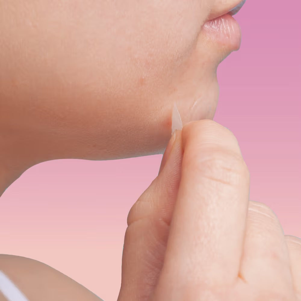 Feel Good Club Pimple Patch With Hydrocolloid & Salicylic Acid For Acne Healing & Spot Correction