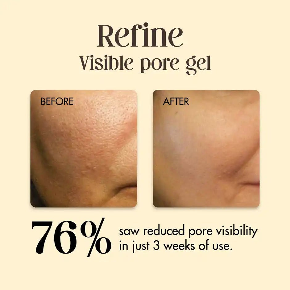 Refine - Open Pores Gel | Secret Alchemist at Broadway