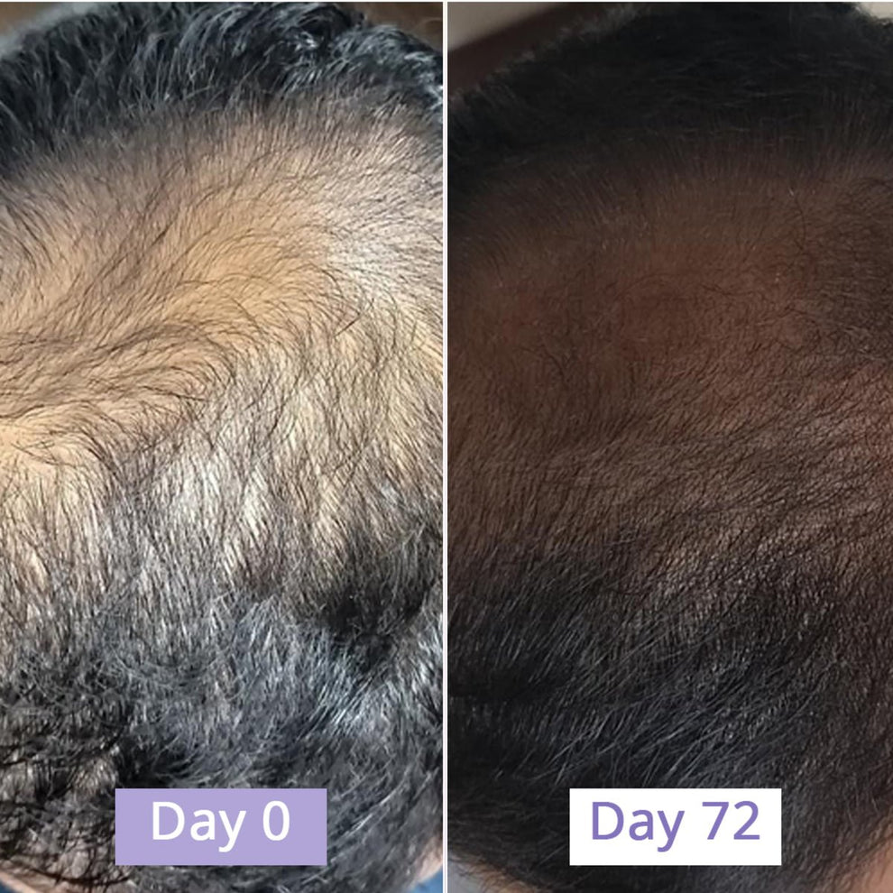 Dr.Su Hair Growth Serum | Dr. Su at Broadway