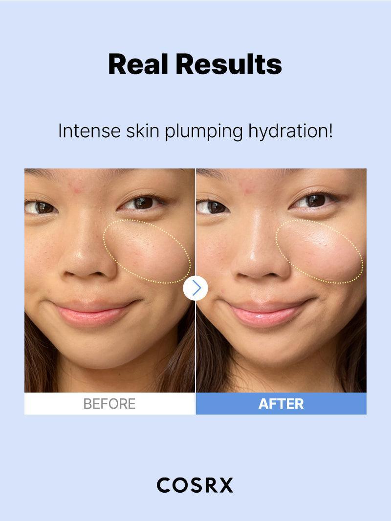 The Hyaluronic Acid 3 Serum | Cosrx at Broadway