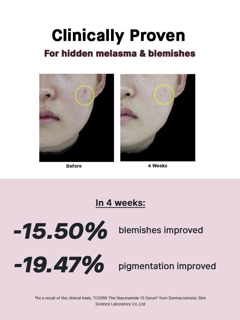The Niacinamide 15 Serum | Cosrx at Broadway